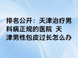 排名公开：天津治疗男科病正规的医院  天津男性包皮过长怎么办