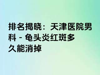 排名揭晓：天津医院男科 - 龟头炎红斑多久能消掉