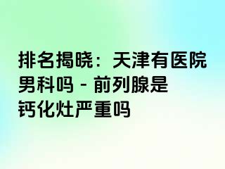 排名揭晓：天津有医院男科吗 - 前列腺是钙化灶严重吗
