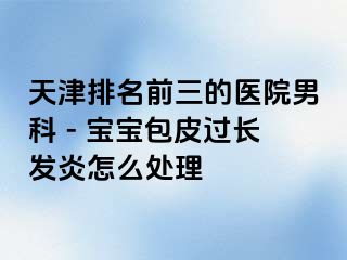 天津排名前三的医院男科 - 宝宝包皮过长发炎怎么处理