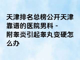 天津排名总榜公开天津靠谱的医院男科 - 附睾炎引起睾丸变硬怎么办