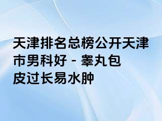 天津排名总榜公开天津市男科好 - 睾丸包皮过长易水肿