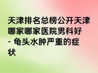 天津排名总榜公开天津哪家哪家医院男科好 - 龟头水肿严重的症状
