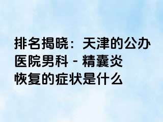 排名揭晓：天津的公办医院男科 - 精囊炎恢复的症状是什么