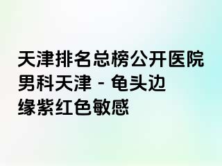 天津排名总榜公开医院男科天津 - 龟头边缘紫红色敏感