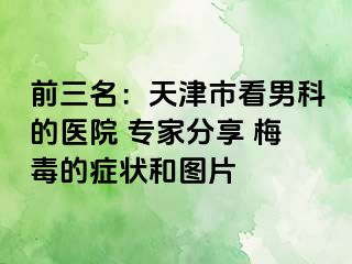 前三名：天津市看男科的医院 专家分享 梅毒的症状和图片